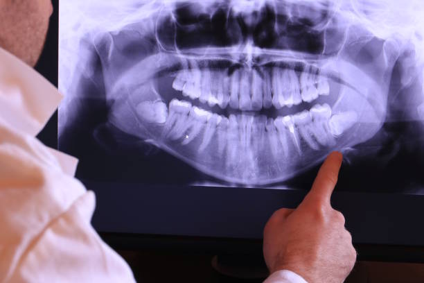 Best Tooth Infection Emergency Dentist  in Oceanport, NJ